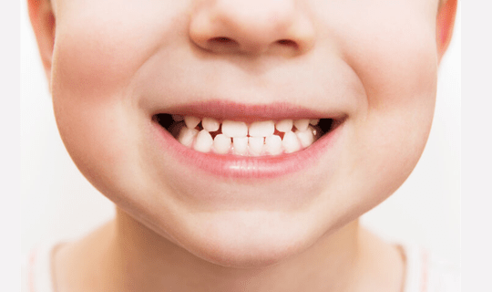 دندان قروچه اثر آشکاری بر ساختار دندان ها ندارد